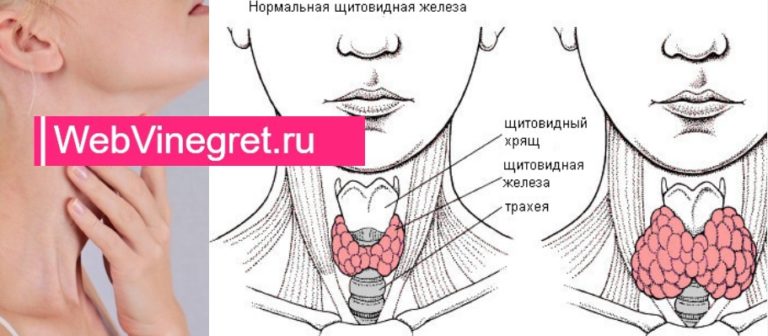 Эта женщина очень устает и постоянно хочет спать. Оказалось, что причина – в горле