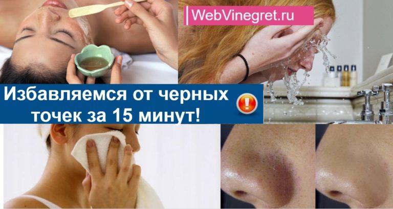 Избавляемся от черных точек за 15 минут!
