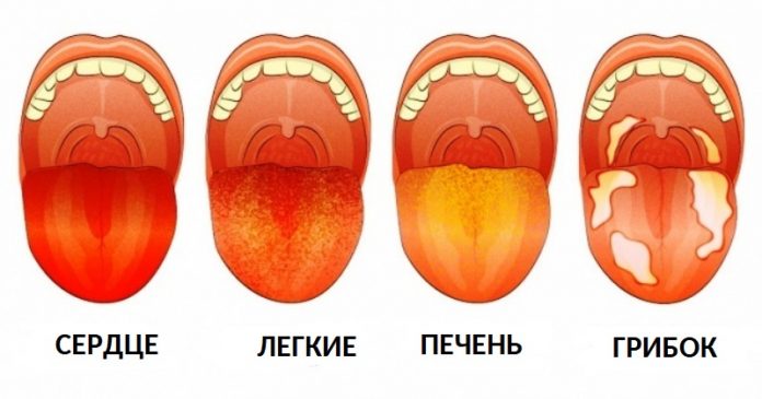 12 проблем со здоровьем, которые вы можете определить, взглянув на свой язык