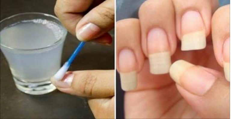Как быстро отрастить ногти, которые никогда не сломаются: поможет простое средство из 4 компонентов!
