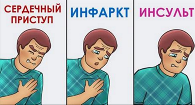 Как различить сердечный приступ, инфаркт и инсульт
