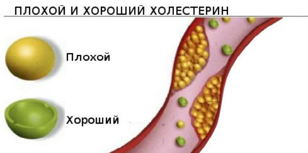 Миф о холестерине — крупнейший обман ХХ века