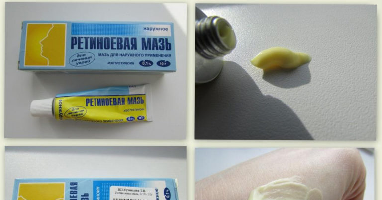Копеечные средства для красоты из аптеки! Обычная косметика в долю не падает