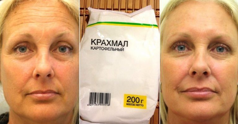 Маска-ботокс из крахмала. 15 минут — и результат будто после нескольких уколов в салоне красоты